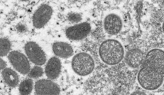 Monkeypox spread through close contact, not mosquito bites